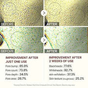 Dr.Melaxin Peel Shot Glow Black Rice Peeling Ampoule 80ml, Dead Skin Gentle Exfoliating Ampoule with Rice Water Extract, AHA BHA, Niacinamide, Daily Skin Texture Care, All Skin Types, Korean Skincare